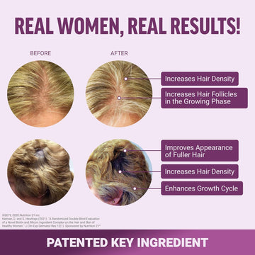 Embrace Growth: Accelerate Your Hair Growth Today!